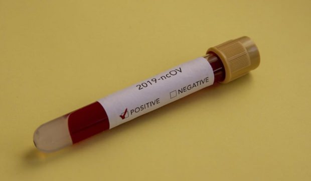 Koronavirüs gıdalardan geçebilir mi?