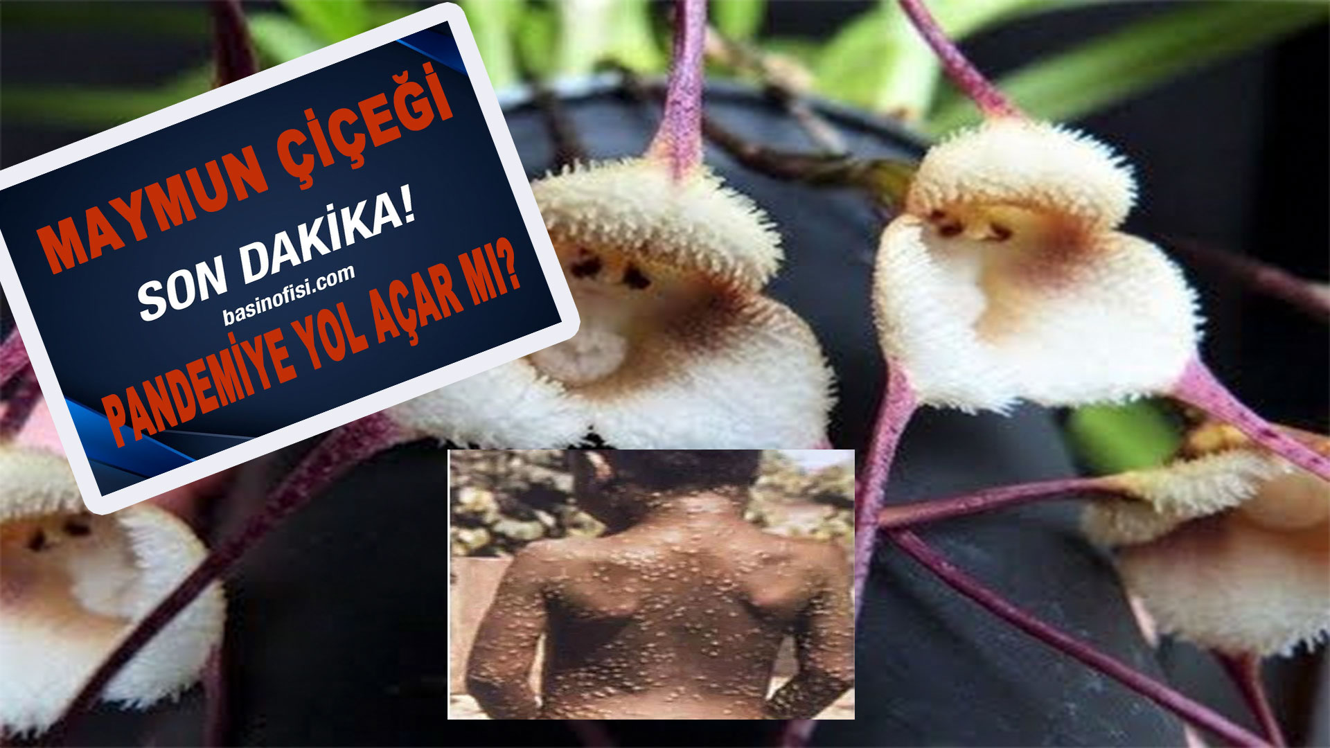 DSÖ’nün Maymun Çiçeği açıklaması tedirgin etti.