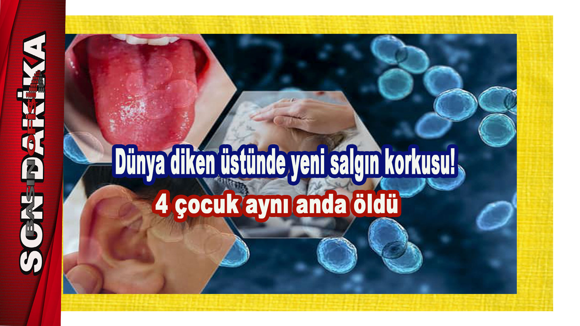 Dünya diken üstünde yeni salgın korkusu! 4 çocuk aynı anda öldü